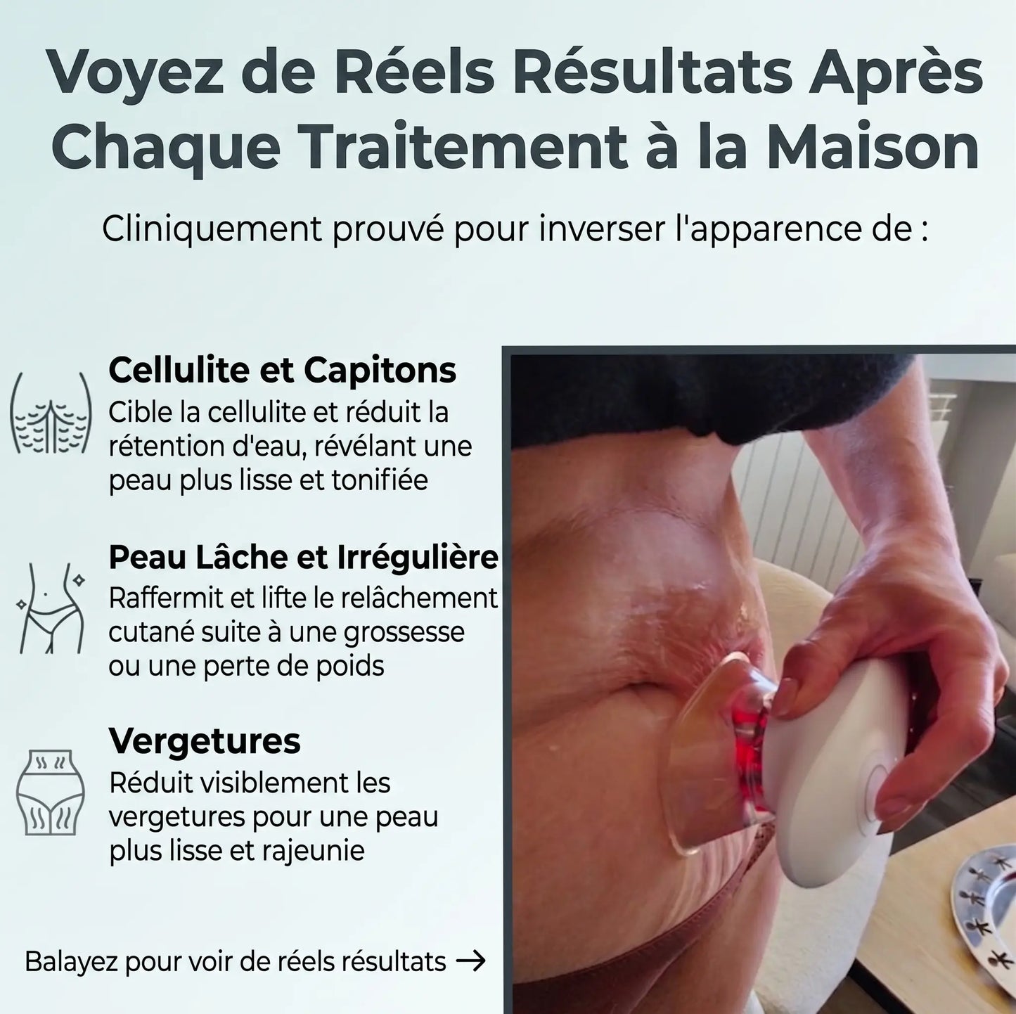 Tonifiez et Raffermissez en seulement 15 Minutes par jour depuis chez vous. Indolore et Cliniquement Prouvé.
