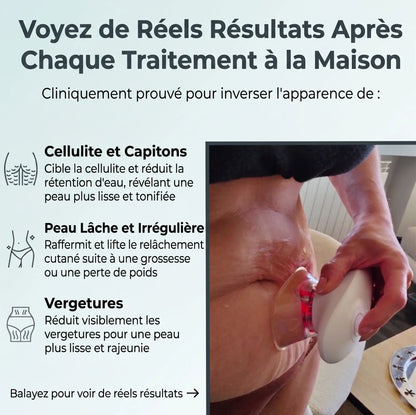 Tonifiez et Raffermissez en seulement 15 Minutes par jour depuis chez vous. Indolore et Cliniquement Prouvé.